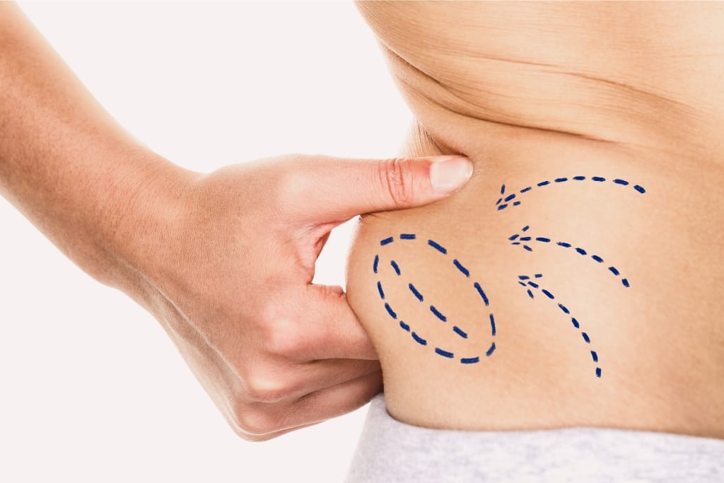 How To Choose A Liposuction Surgeon