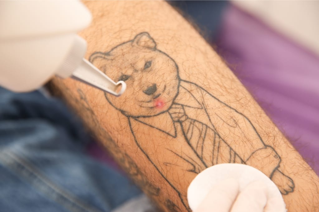 7 Reasons Why People Regret Their Tattoos