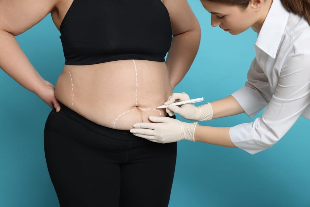 10 Lifestyle Changes To Make After Liposuction For Best Results