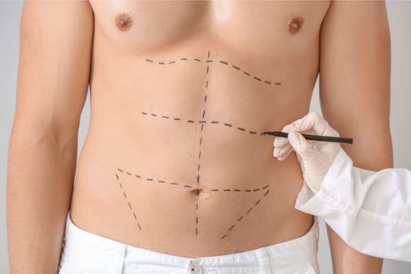 How To Negotiate The Best Price For Cosmetic Surgery